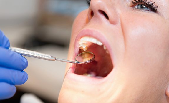 Dentist using dental mirror in woman’s mouth
