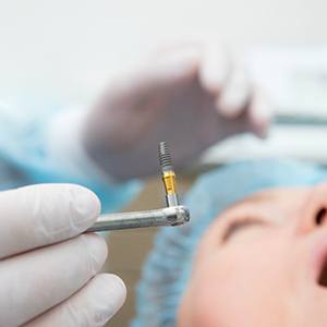 closeup of a gloved hand holding a dental implant with the patient in the background 