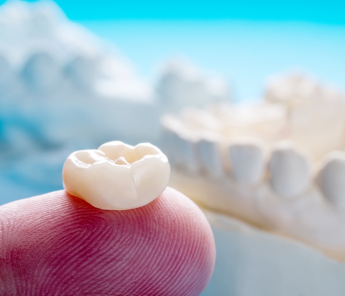 Closeup of a dental crown resting on a fingertip