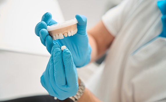 Dentist with blue gloves showing how crown fits over model abutment tooth