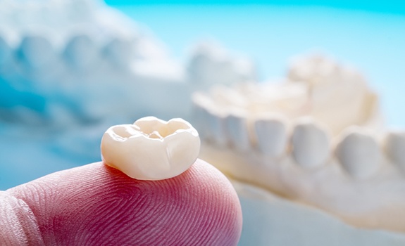 Dental crown resting on person's finger tip