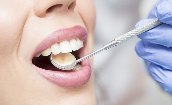 Dentist checking patient's metal free dental restoration