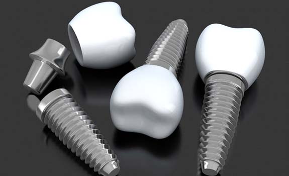 Several dental implants in Rowley on dark background
