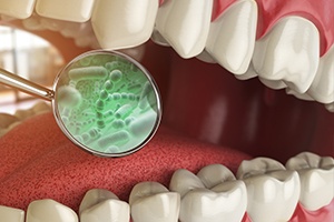 Animated smile with enlarged bacteria