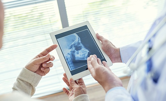 Dentist examining x-ray during T M J diagnosis and treatment planning