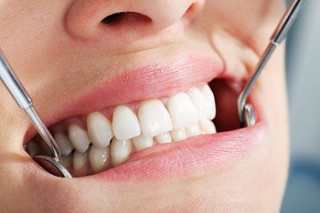 Close-up of teeth during dental examination