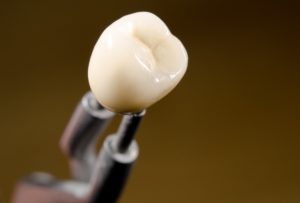 Porcelain crown in dental lab